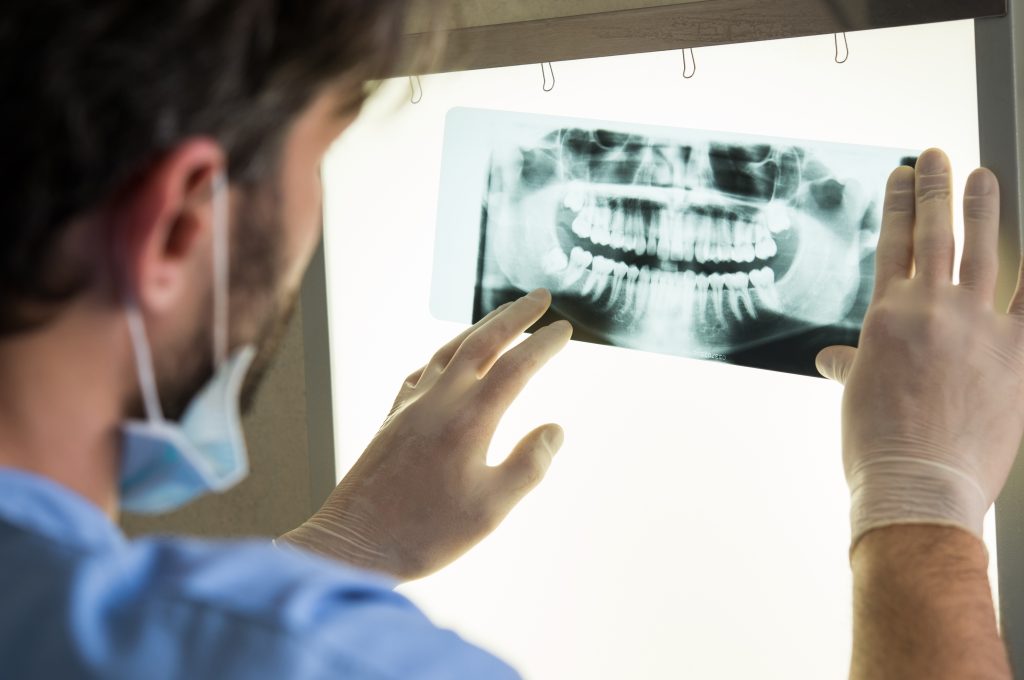 doctor/dentist looking at dental x-ray