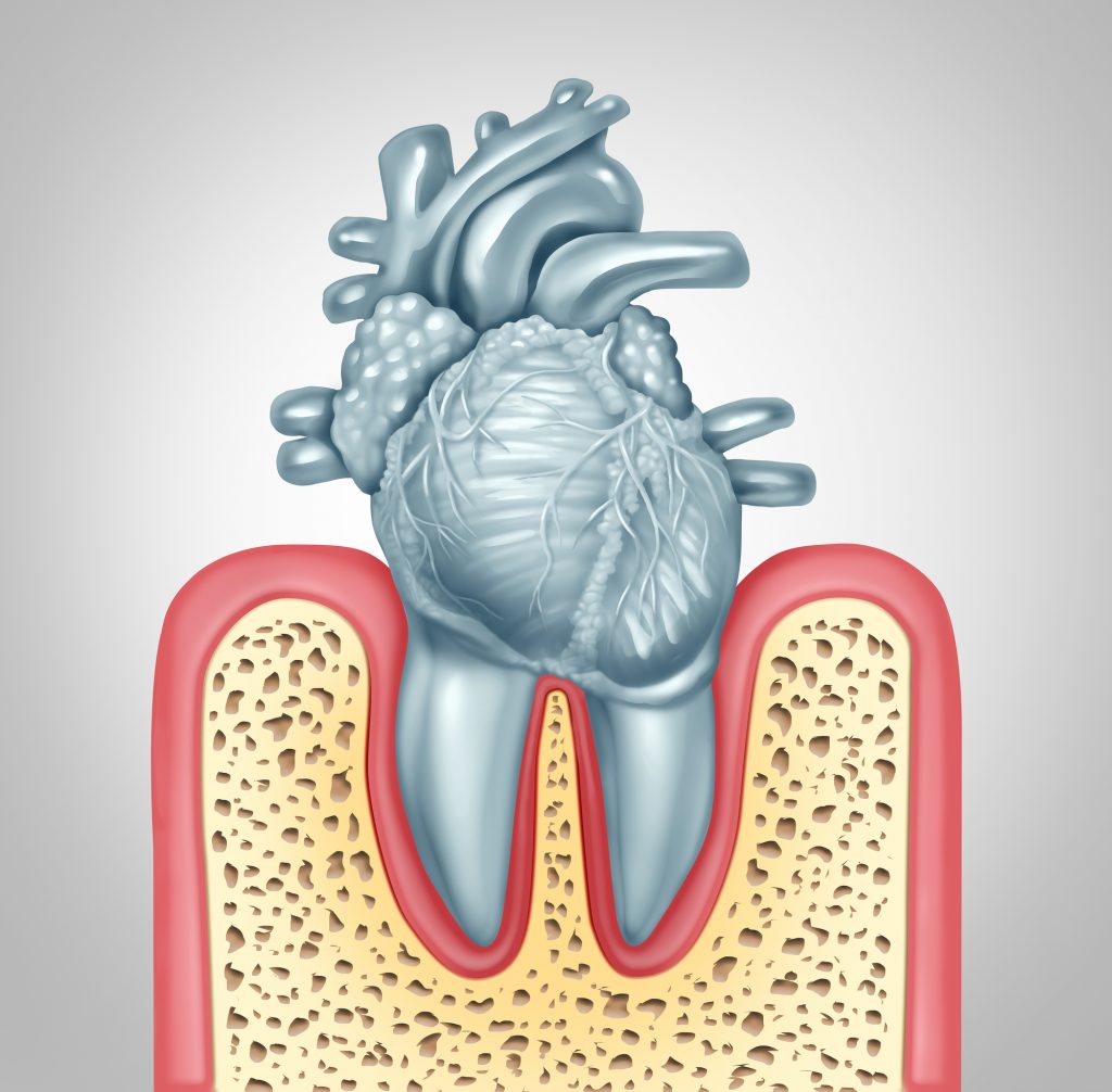 Dental Care Heart Disease