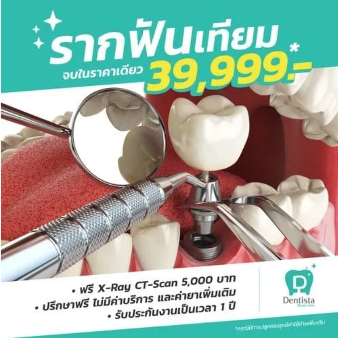 Dental Implant Abutment & Crown