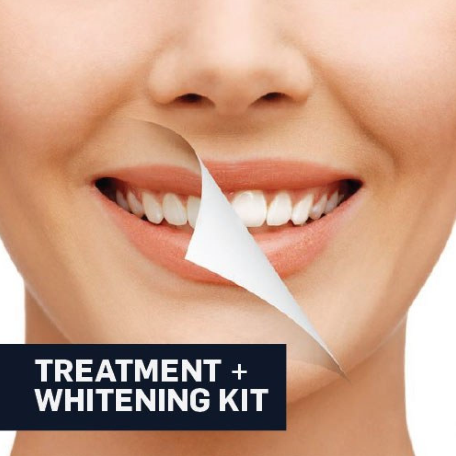 One-Hour Zoom Teeth Whitening Melbourne Dentist Promotional Package