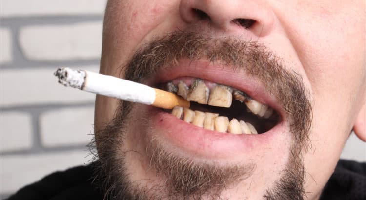 oral problems linked to cigarette smoking such as teeth staining and gum disease