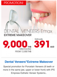 Emax Dental Veneer Promotion