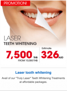 Laser Teeth Whitening Bangkok Smile Dental