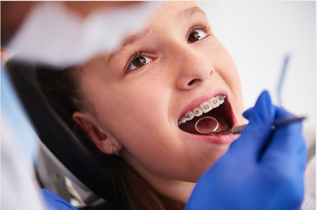 At what age can a child get braces?