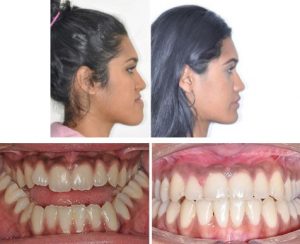 Sydney Oral Facial Surgery